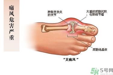 痛风可以吃木耳吗?痛风不能吃什么