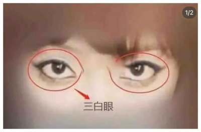 ​下三白眼女人面相如何？